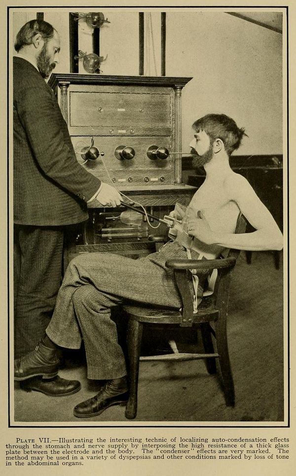 Vintage black and white photograph of a medical procedure involving a young man connected to a complex electrical therapy machine.