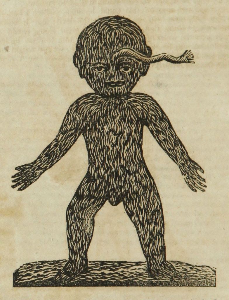 Vintage illustration of a child covered in hair-like lines, standing on a textured ground.