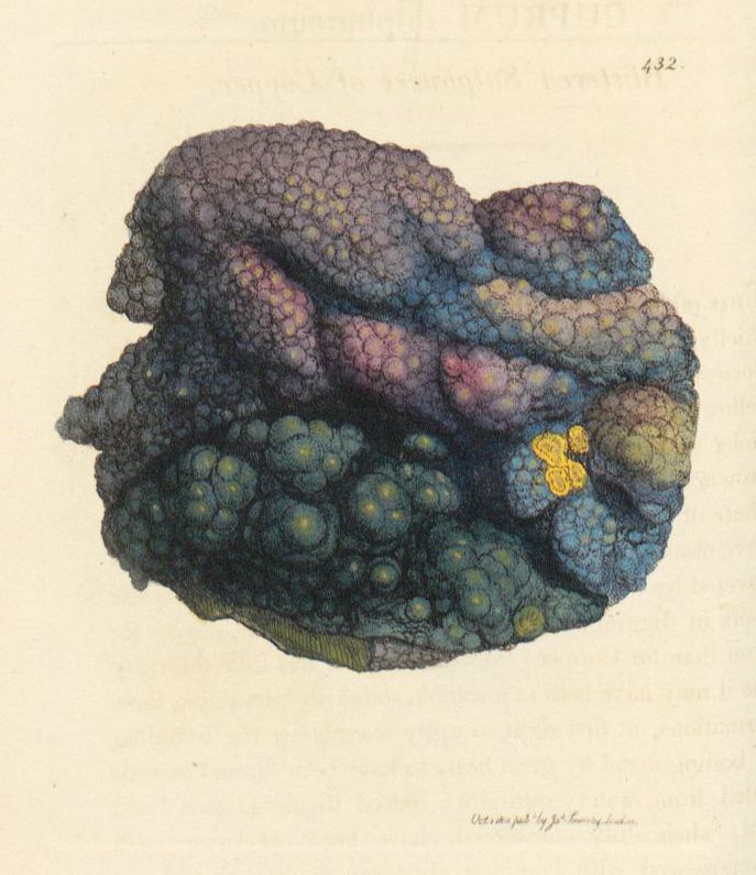 Vintage medical illustration of a tumor or abnormal growth, composed of numerous small, rounded protrusions in shades of purple, blue, green, orange, and yellow.