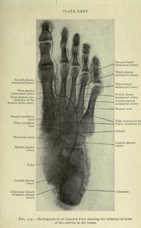 Vintage radiographic image of an injected human foot with labeled bones and arteries.