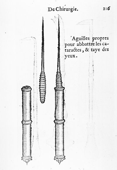 A historical medical illustration of surgical needles used for cataract removal or eye surgery.