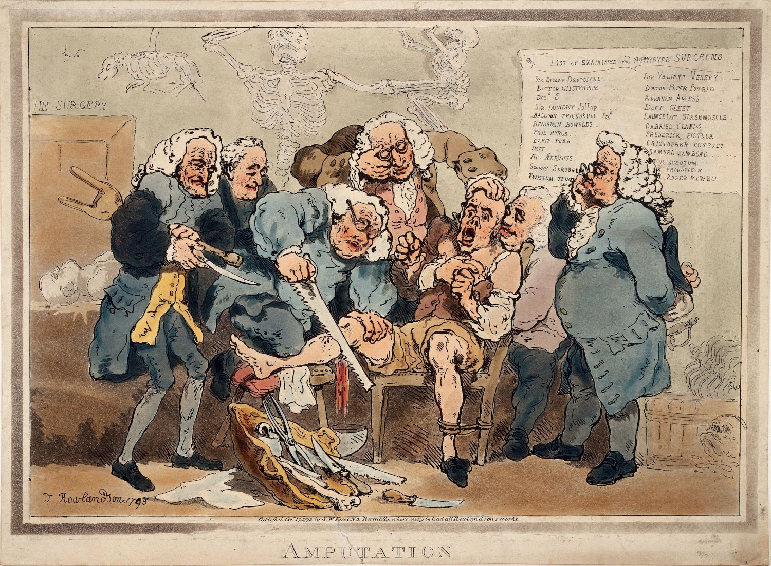 A black and white cartoon titled 'Amputation' by J. Rowlandson, published in 1799. It depicts a chaotic scene inside a surgery room with a man undergoing an amputation of his leg.