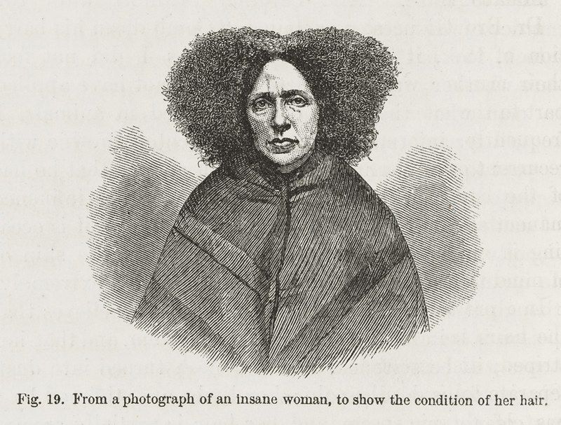 Black and white engraving of an insane woman with extremely matted and tangled hair.