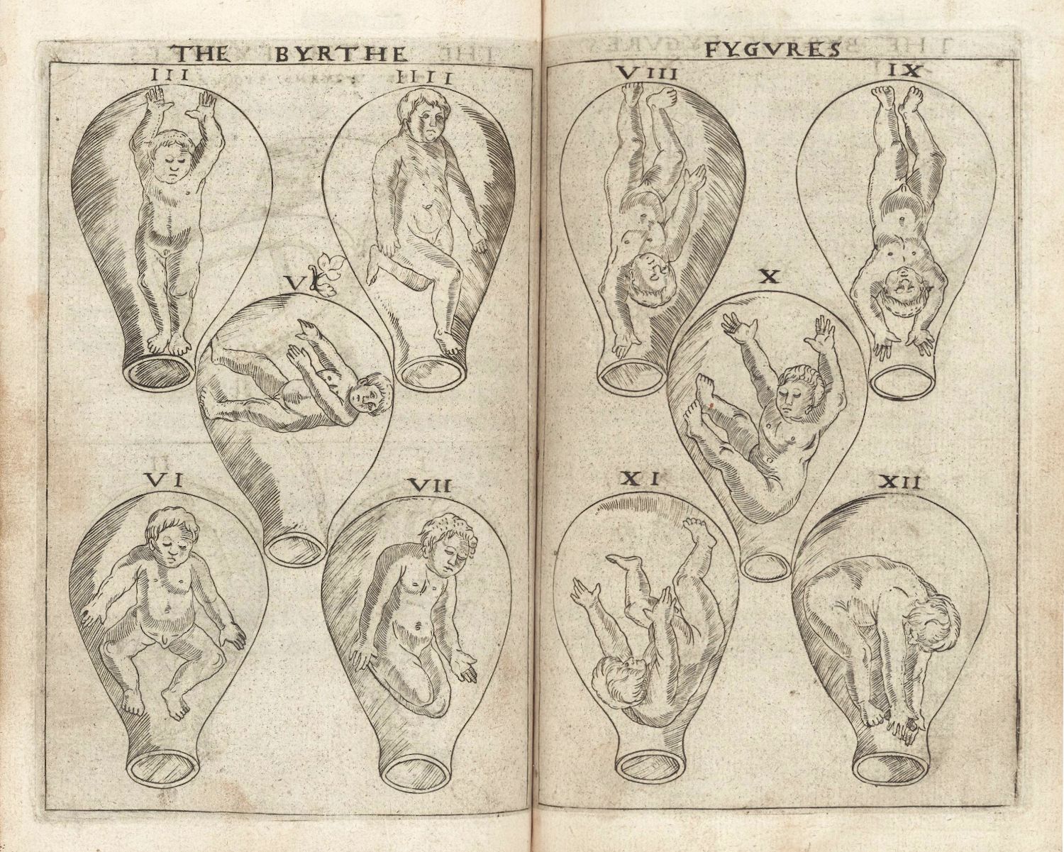 Vintage illustration of fetal development stages within the uterus, labeled with Roman numerals.