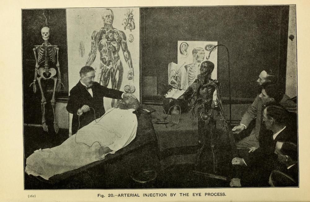 A historical medical illustration depicting an arterial injection process being performed on a patient by a doctor, with anatomical charts of the human body displayed on the walls.