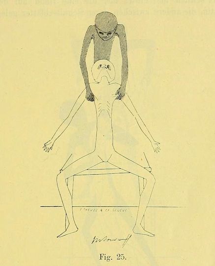 Vintage illustration of two emaciated figures in a contorted pose.