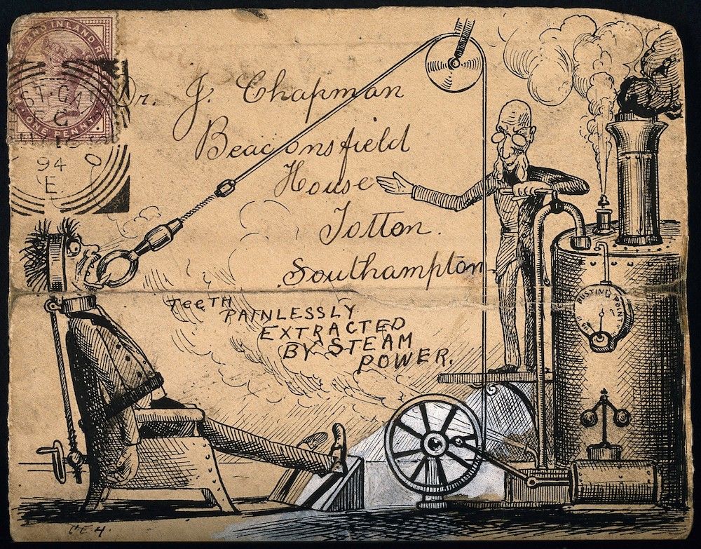 Vintage illustration of a dentist using a steam-powered tool to extract teeth.