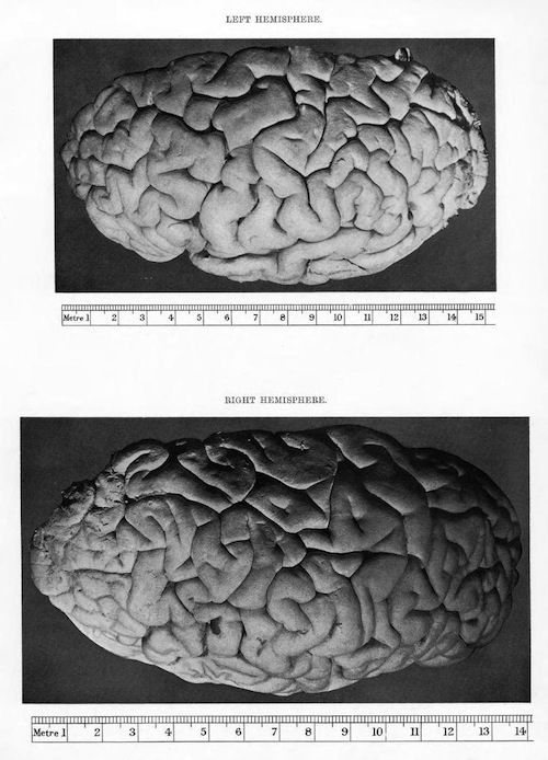 Vintage anatomical illustration of left and right brain hemispheres with metric scales.