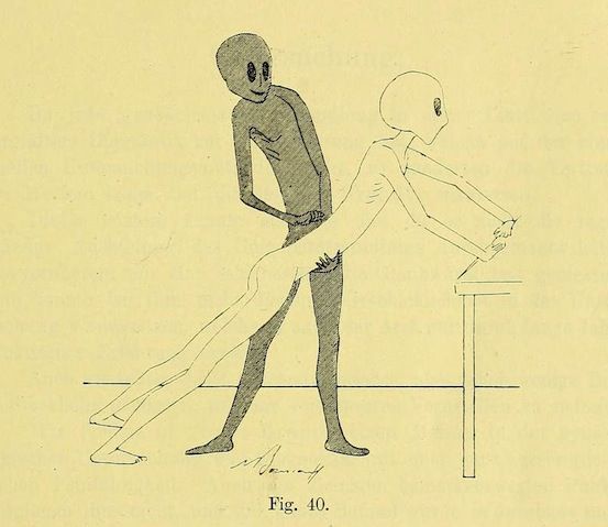 A vintage medical illustration depicting two emaciated figures, one standing and examining the leg of the other who is lying on a table.