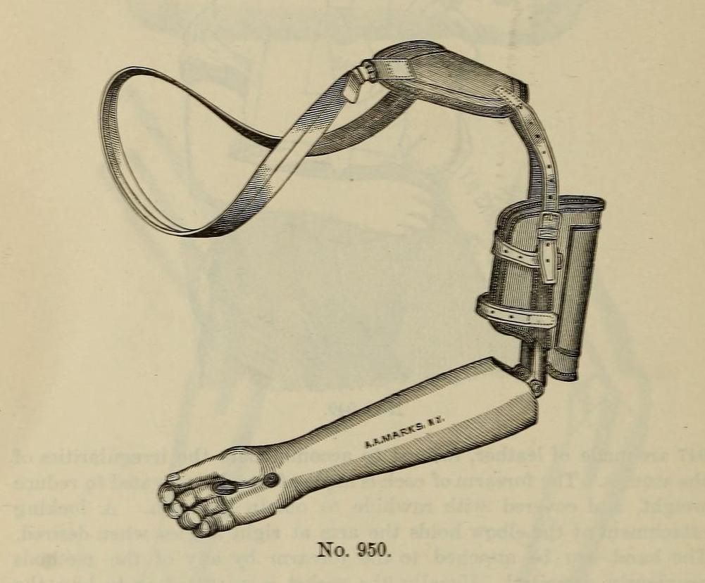 Vintage illustration of a prosthetic arm and its supporting harness.