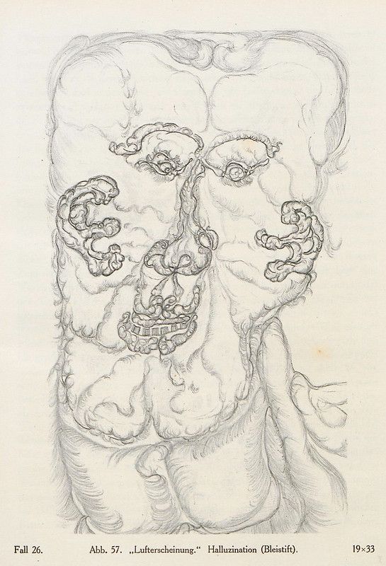 A vintage, black and white drawing of a distorted face, likely depicting a hallucination. The drawing is done in a chaotic, scribbled style with swirling lines and shapes.