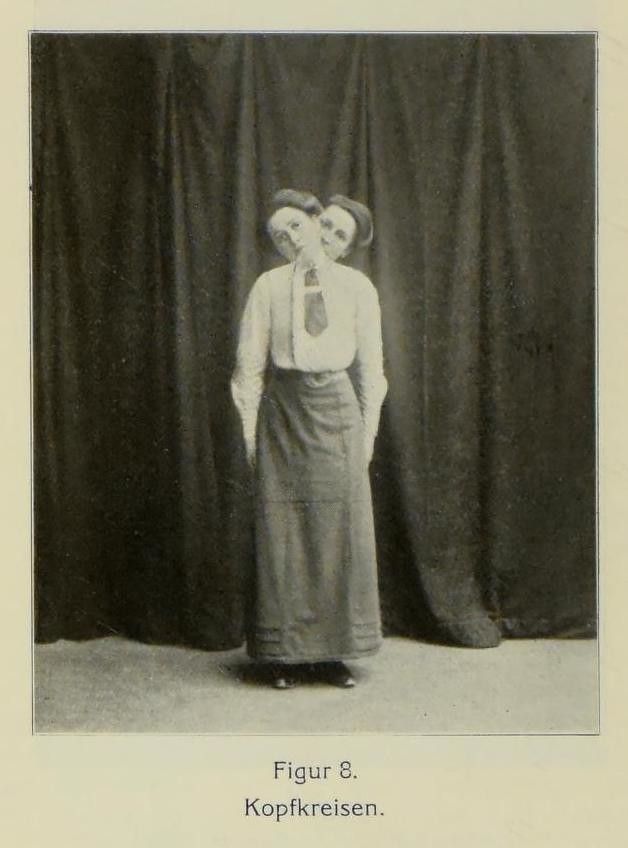 Vintage photograph of a person with two heads stacked on top of each other, wearing a long-sleeved shirt and skirt, against a dark curtain background. Text below reads 'Figur 8. Kopfkreisen.'