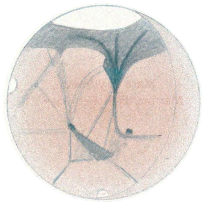 Microscopic view of a radiolarian with intricate internal structure.